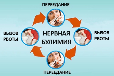 Лечение булимии в Высоковске